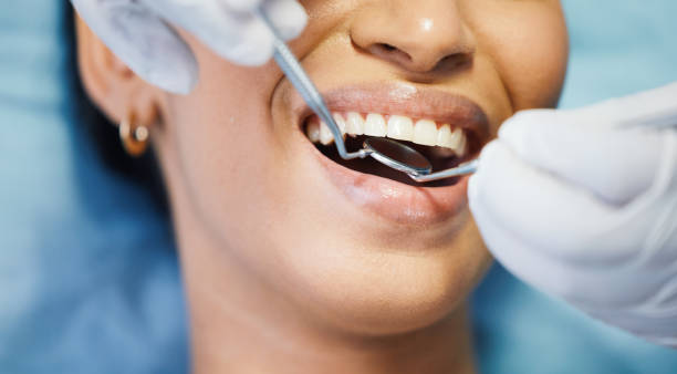 Best Emergency Dental Care for Broken or Chipped Teeth in Rainelle, WV